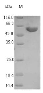 Lymphocytic Choriomeningitis Virus GPC Protein (Recombinant 6His-SUMO, N-terminus)