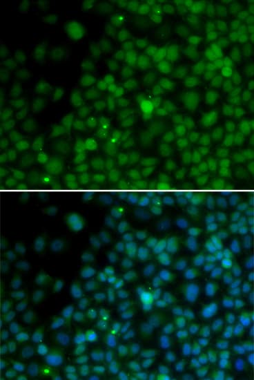 IRF4 Antibody