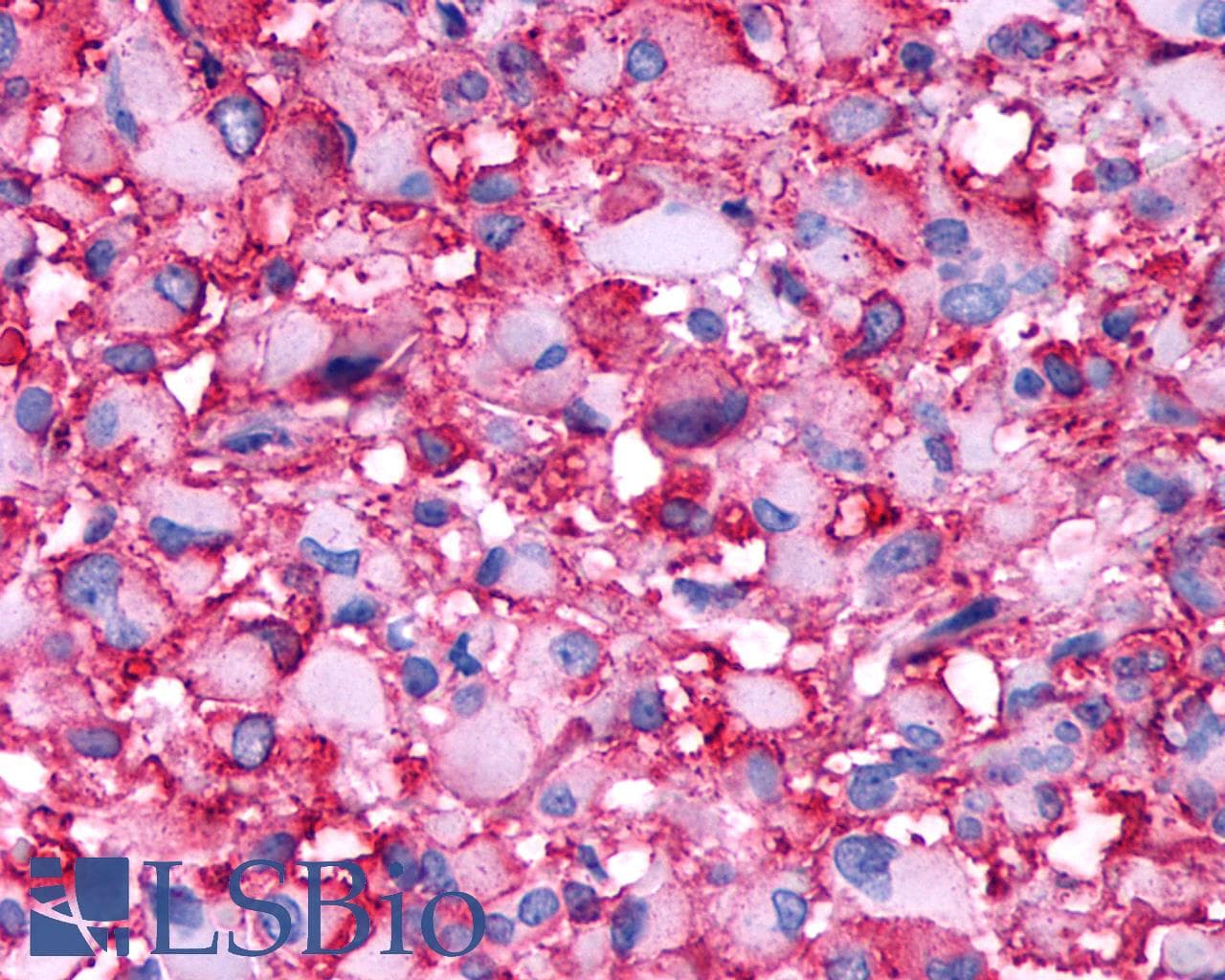 PathPlus™ Polyclonal Rabbit anti-Human DRD4 / Dopamine Receptor D4 Antibody (C-Terminus, IHC)