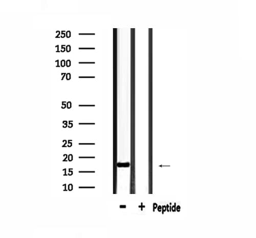 MGST2 Antibody