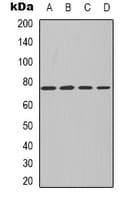 PKC Iota + PKC Zeta Antibody (Internal)