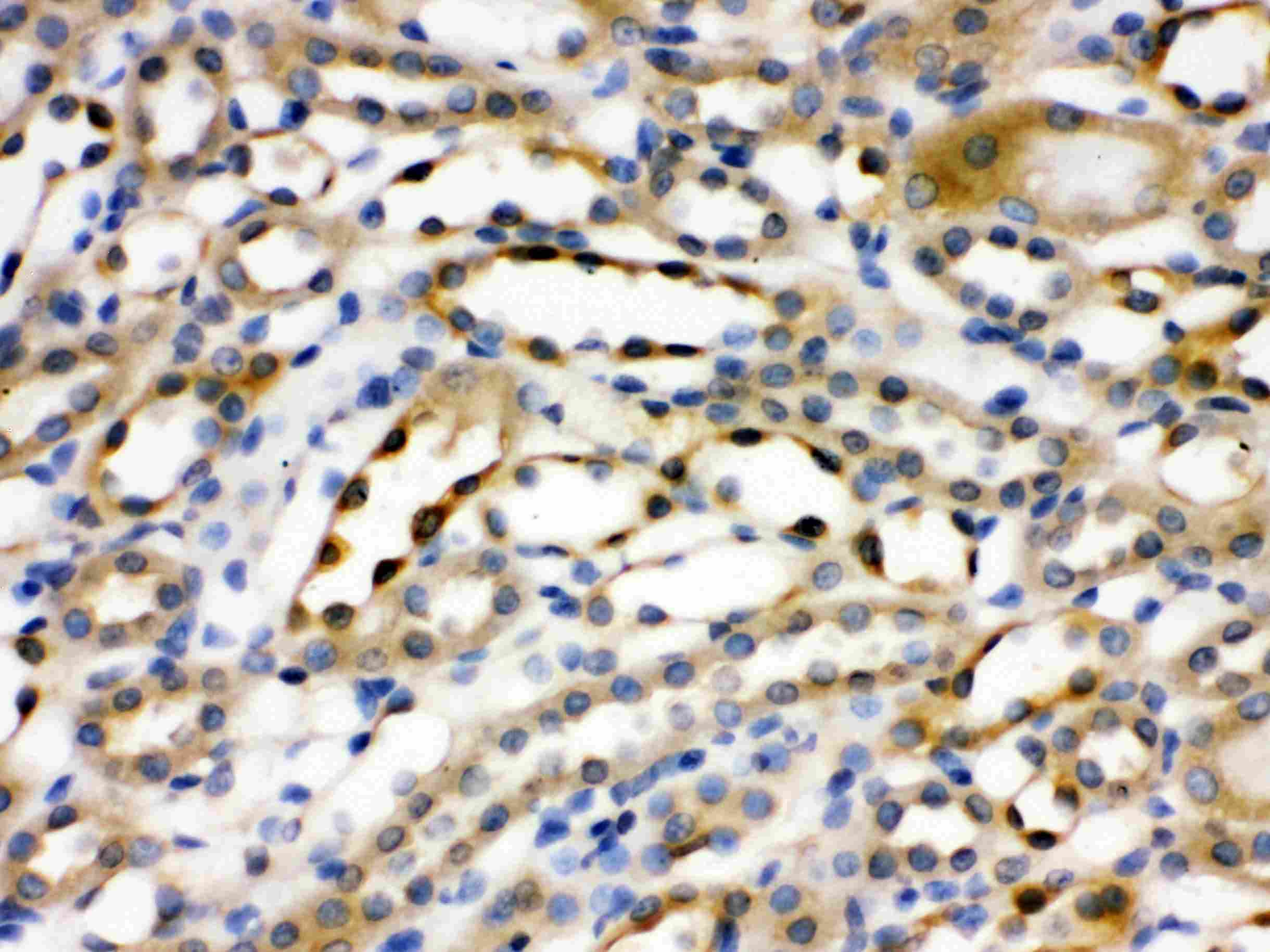 ACTN4 Antibody