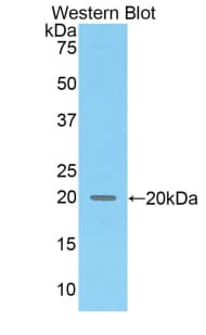 COL8A2 / Collagen VIII Antibody (aa537-703)
