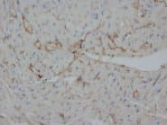Polyclonal Rabbit anti-Human INSR / Insulin Receptor Antibody (Sepharose, N-Terminus)