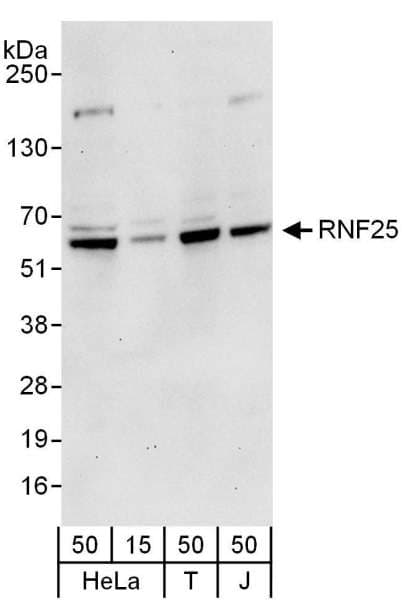 RNF25 Antibody (aa409-459)