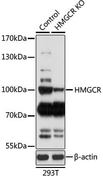 Polyclonal Rabbit anti-Human HMG-CoA Reductase / HMGCR Antibody (IHC, WB)