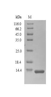 Human PSCA Protein (Recombinant 6His, N-terminus)