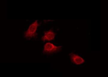 Polyclonal Rabbit anti-Human SH3TC1 Antibody (IF, WB)