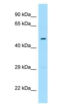 Polyclonal Rabbit anti-Human FLOT1 / Flotillin 1 Antibody (aa247-296, WB)