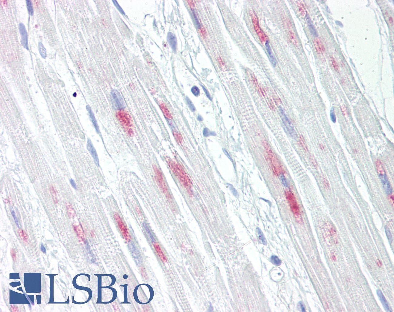 IHC-plus™ Polyclonal Rabbit anti-Human CRYAB / Alpha B Crystallin Antibody (aa21-70, IHC)