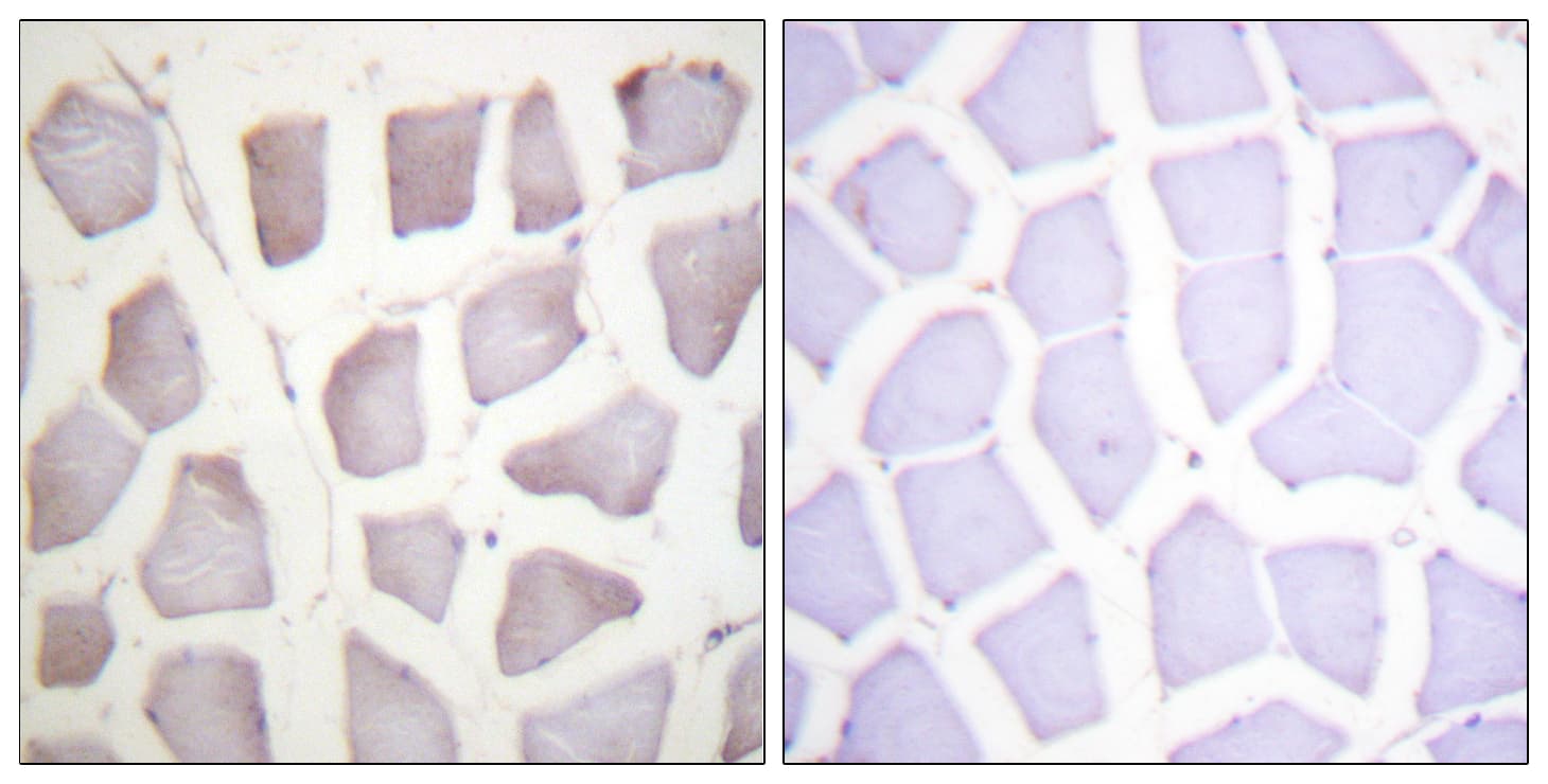 CRYAB / Alpha B Crystallin Antibody (phospho-Ser59)