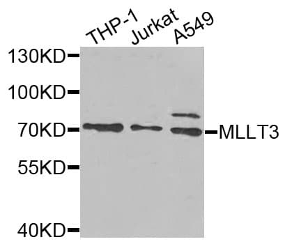 Polyclonal Rabbit anti-Human MLLT3 / AF9 Antibody (IHC, WB)