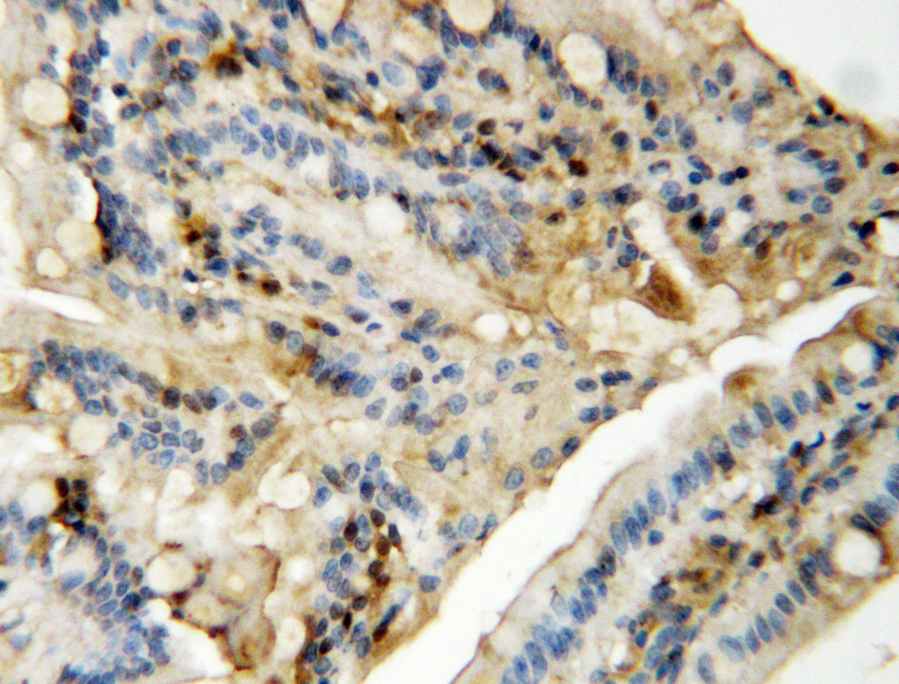 Polyclonal Rabbit anti-Human MAPK8 / JNK1 Antibody (aa344-363, IHC, WB)