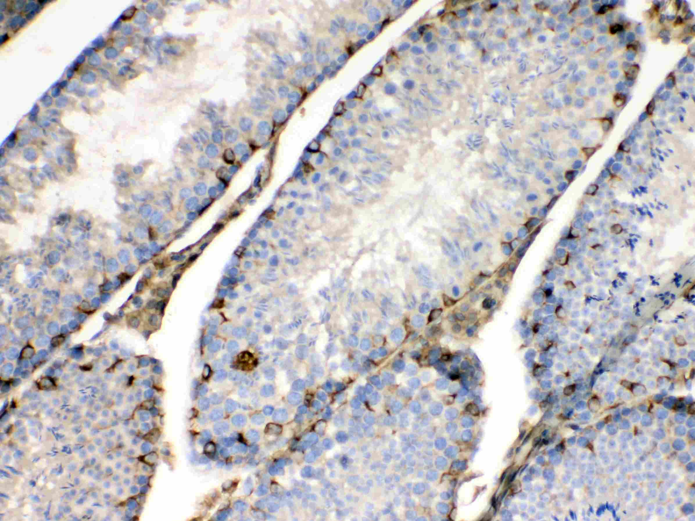 BAG1 / BAG-1 Antibody