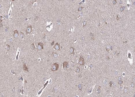 BMP6 Antibody