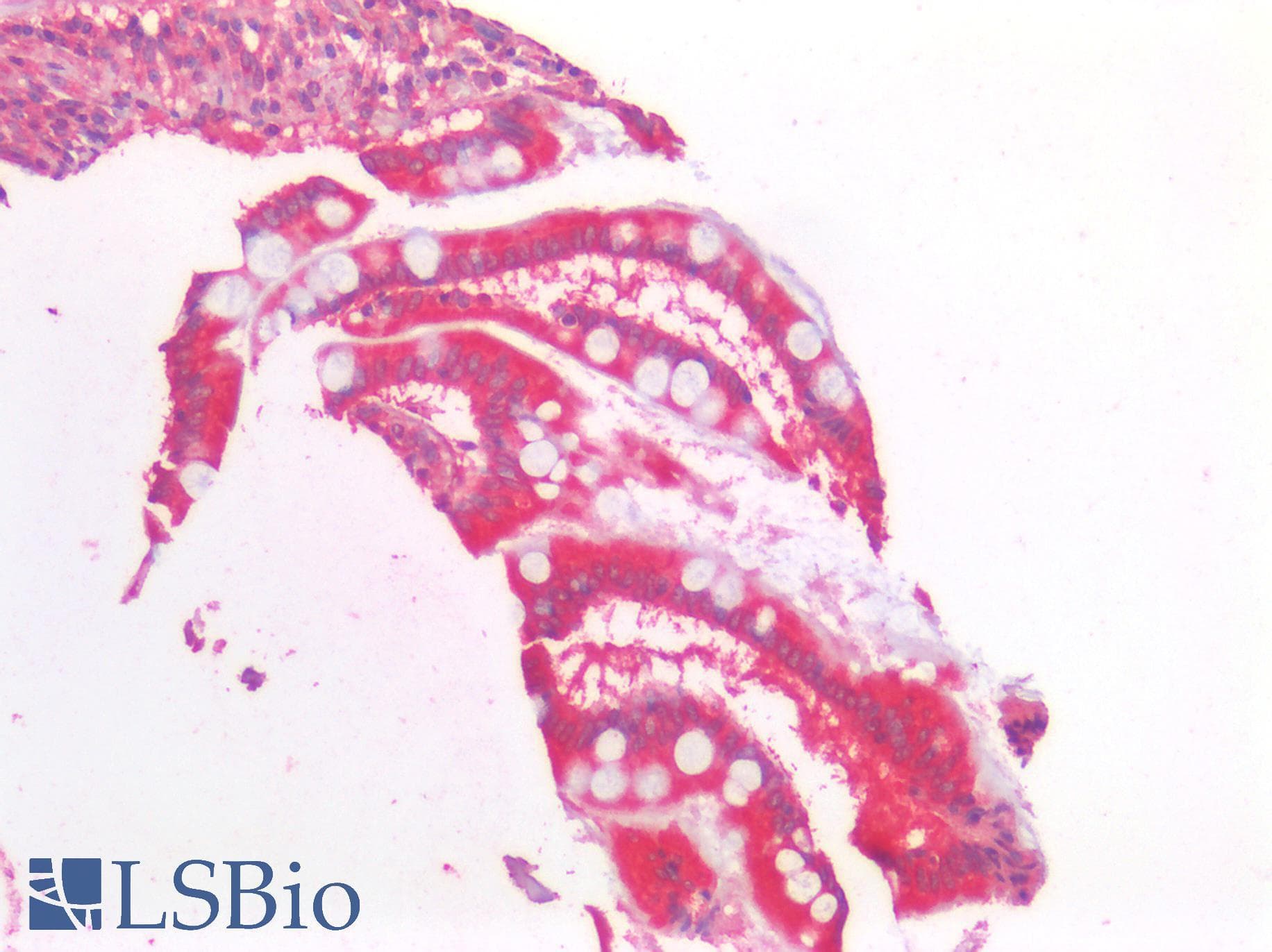 IHC-plus™ AMACR / P504S Antibody (aa312-326)