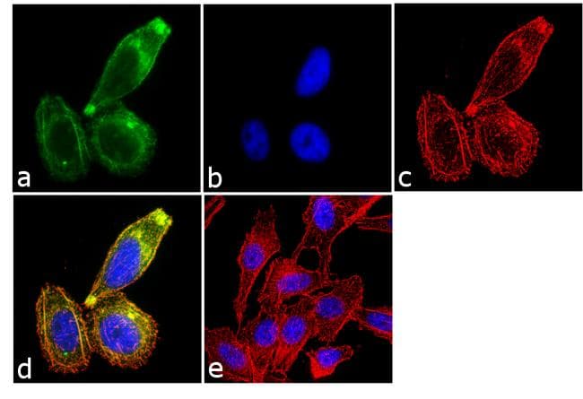Monoclonal Mouse anti-Human FSH Antibody (clone 1G6D12, IF, WB)
