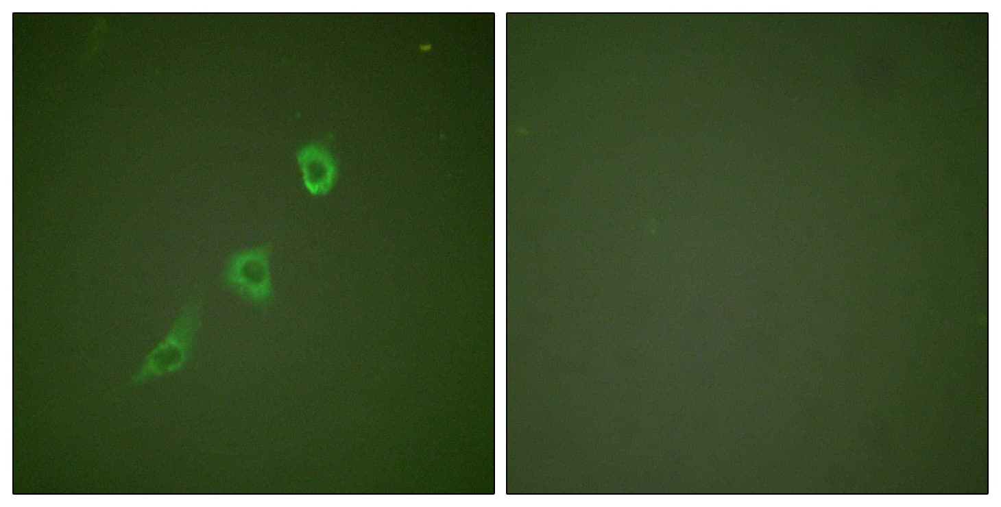 IHC-plus™ HSPE1 / HSP10 / Chaperonin 10 Antibody (aa51-100)