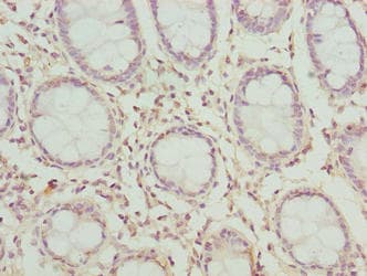 Polyclonal Rabbit anti-Human CLYBL Antibody (IHC, WB)