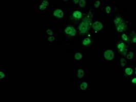 TP53 / p53 Antibody (clone OTI2H4)
