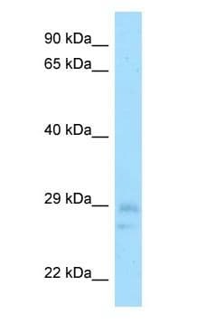 Polyclonal Rabbit anti-Mouse CNOT8 Antibody (N-Terminus, WB)