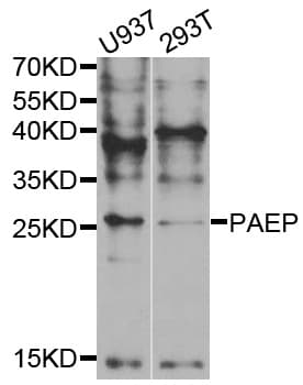 IHC-plus™ Polyclonal Rabbit anti-Human PAEP / Glycodelin / GdF Antibody (IHC, IF, WB)