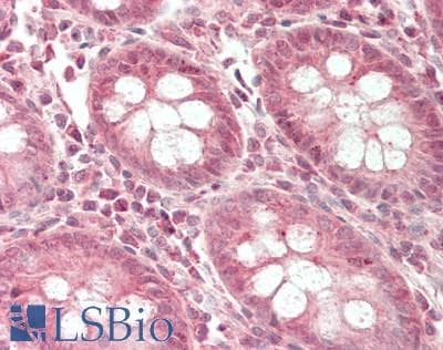 ATG3 Antibody (HRP)