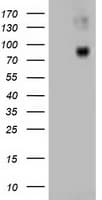 CTNNB1 / Beta Catenin Antibody (clone OTI1G1)