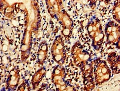 Polyclonal Rabbit anti-Human Antithrombin-III Antibody (IHC, WB)