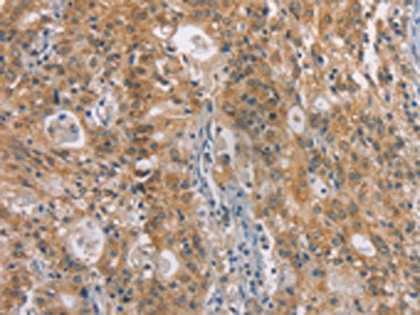 ZADH2 Antibody