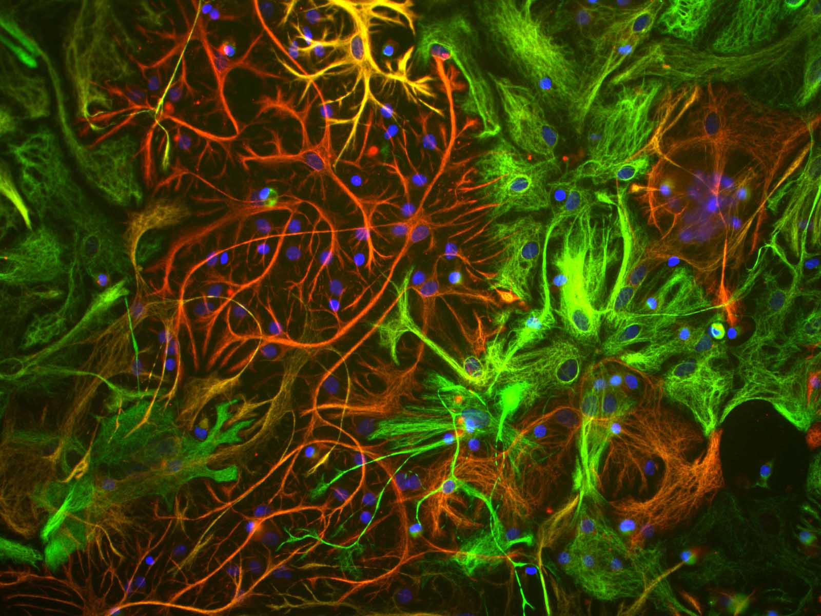 Vimentin Antibody (clone 2D1)