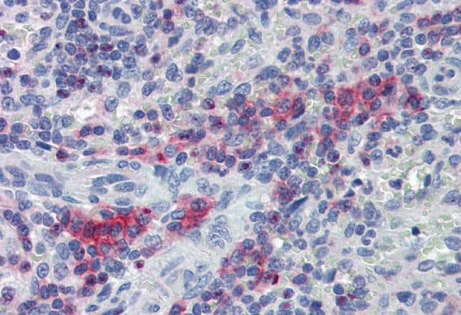 LIME1 / LIME Antibody