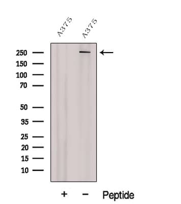 Polyclonal Rabbit anti-Human CSPG4 / NG2 Antibody (IHC, IF, WB)