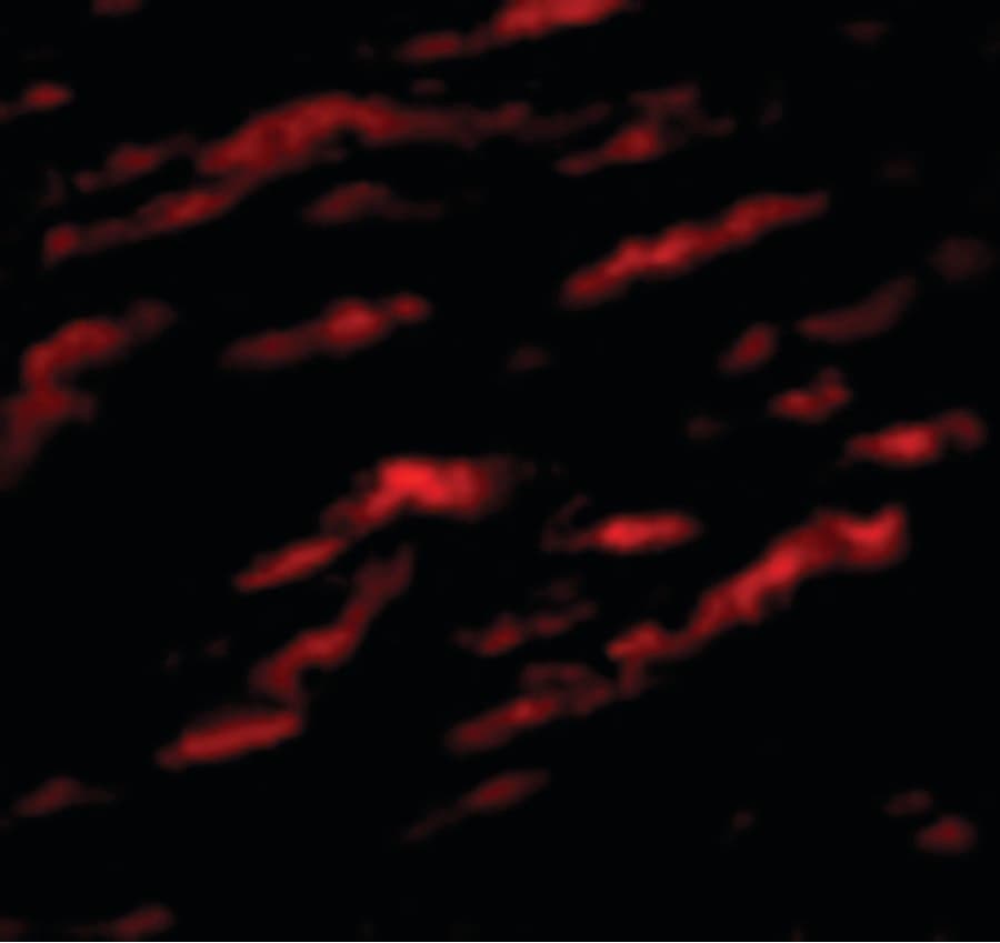 IHC-plus™ MATN1 / Matrilin 1 Antibody