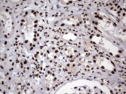 HNRPM / HNRNPM Antibody (aa1-261, clone OTI4C9)