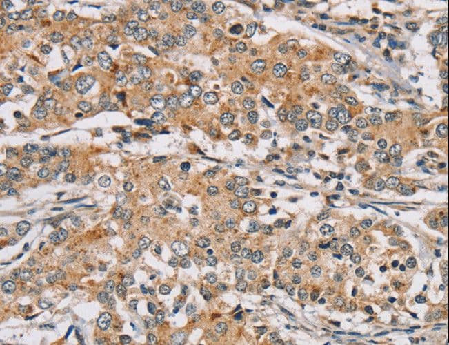 RAB24 Antibody