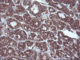 SULT1A1 / Sulfotransferase 1A1 Antibody (clone OTI5A1)