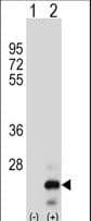 TNFSF18 / GITRL Antibody (aa114-143)