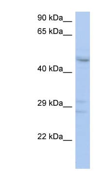 PXYLP1 / ACPL2 Antibody (aa143-192)