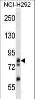 Polyclonal Rabbit anti-Human ADD3 Antibody (aa552-580, WB)