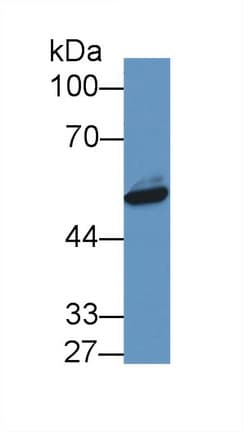 NAMPT / Visfatin Antibody (aa1-491, APC)