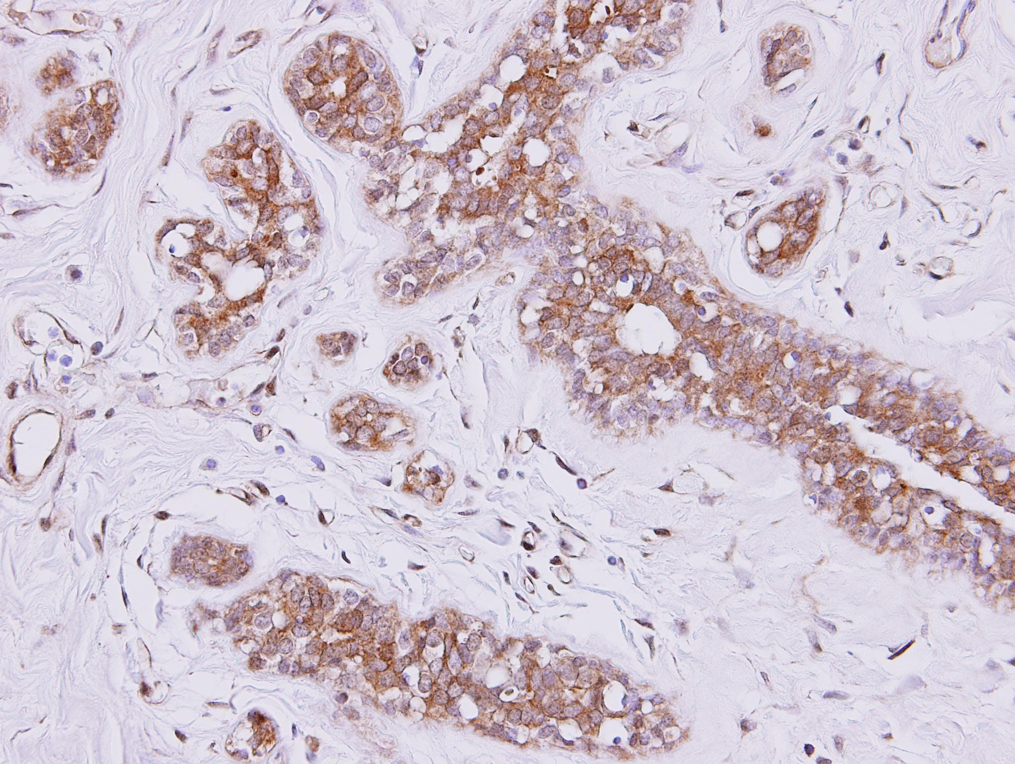 FSD2 Antibody (aa1-215)