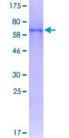 Human NSBP1 / HMGN5 Protein (Recombinant GST)