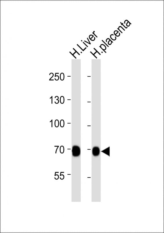 FLT1 / VEGFR1 Antibody (clone 1453CT519.277.79)