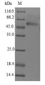 Human LECT1 / Chondromodulin-I Protein (Recombinant 6His-SUMO, N-terminus)