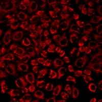 SLC25A20 / CACT Antibody