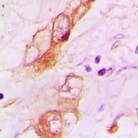 HTR3A / 5-HT3A Receptor Antibody
