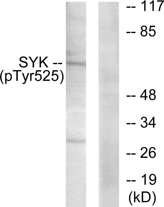 SYK Antibody (phospho-Tyr525)