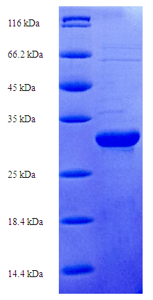 Human S100A7A / S100A15 Protein (Recombinant His-SUMO)