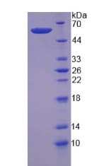 Human CAPN6 / Calpain 6 Protein (Recombinant)